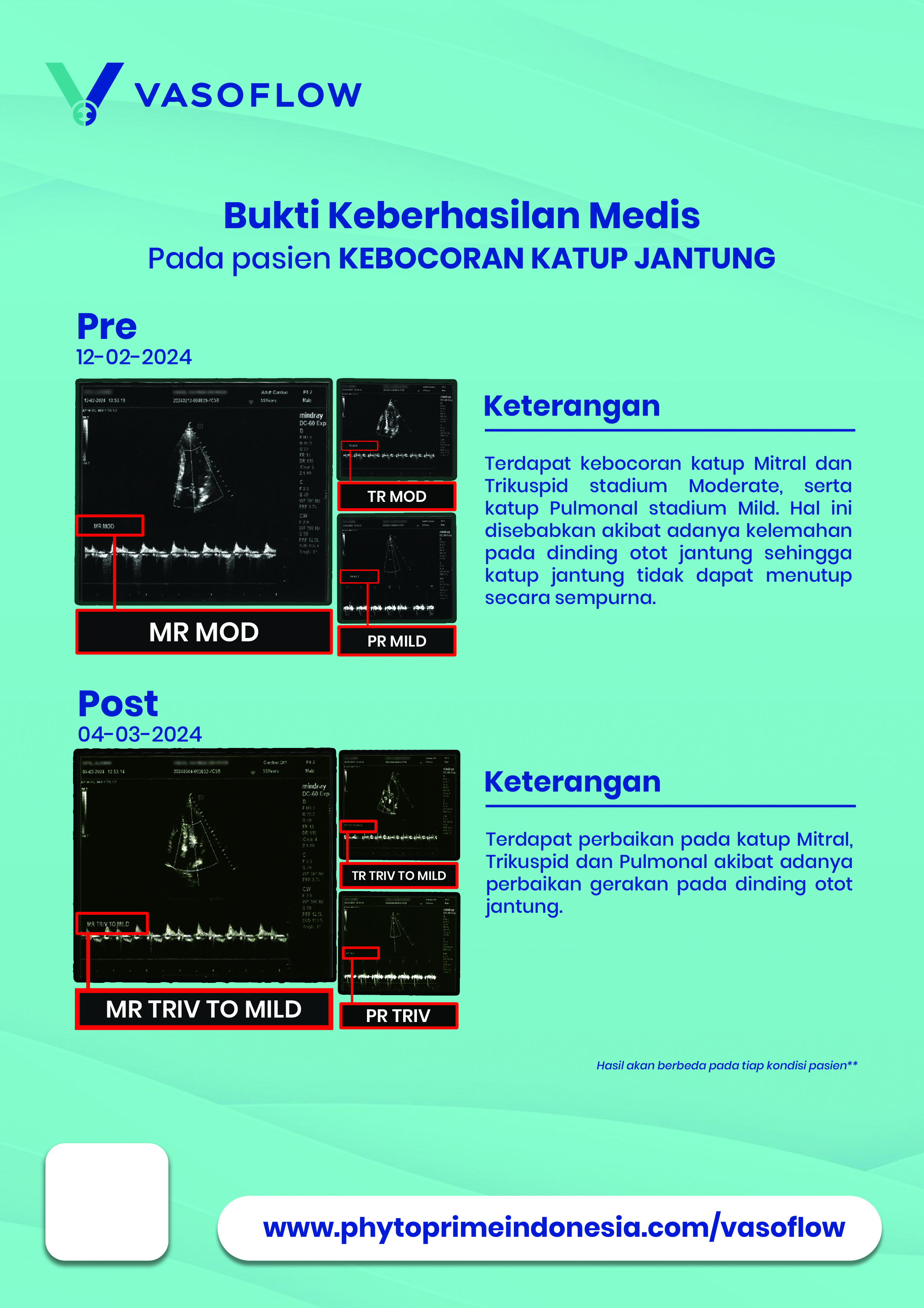Sample hasil medis Vasoflow
